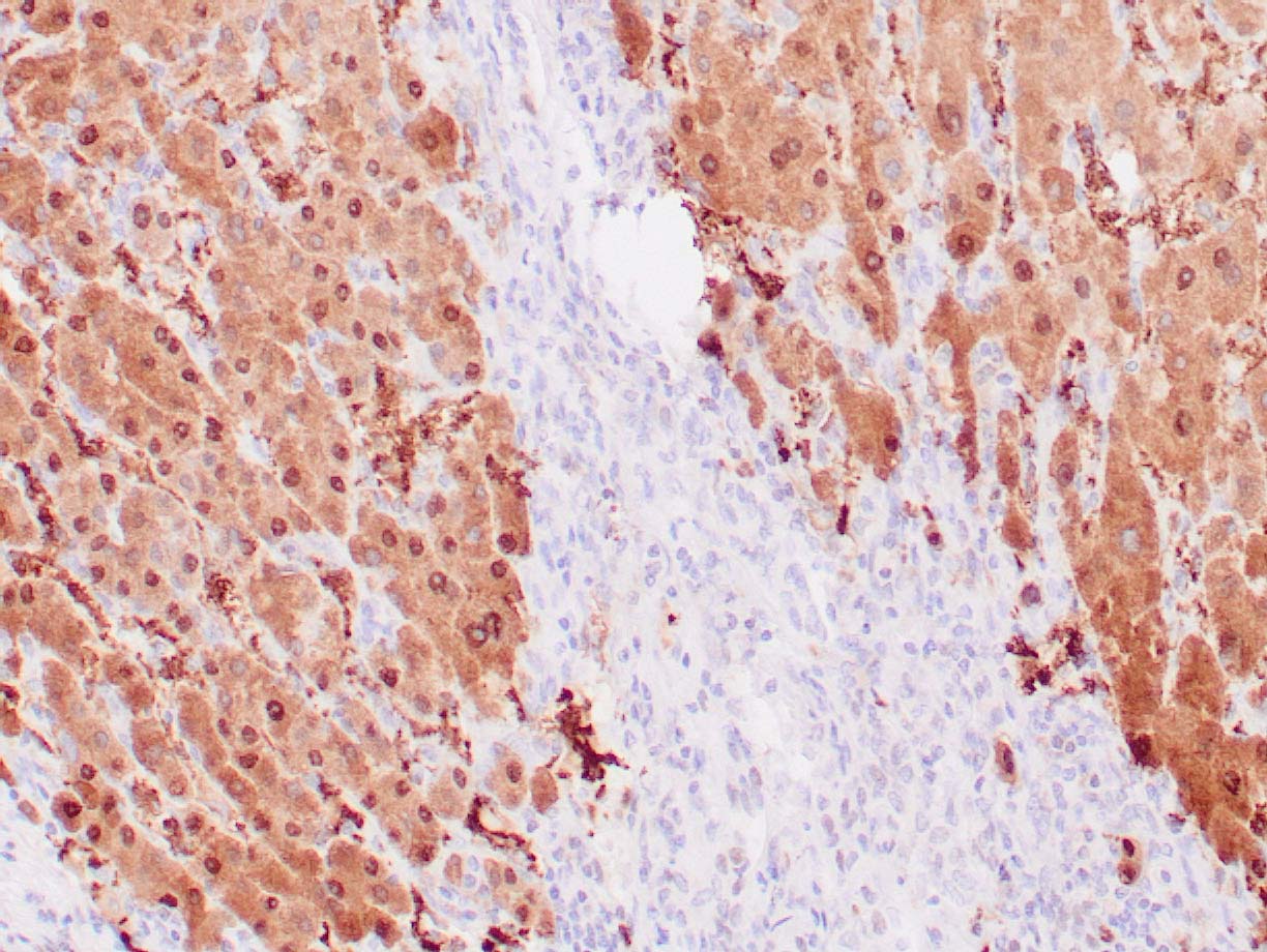 Arginase 1 Zeta Corporation