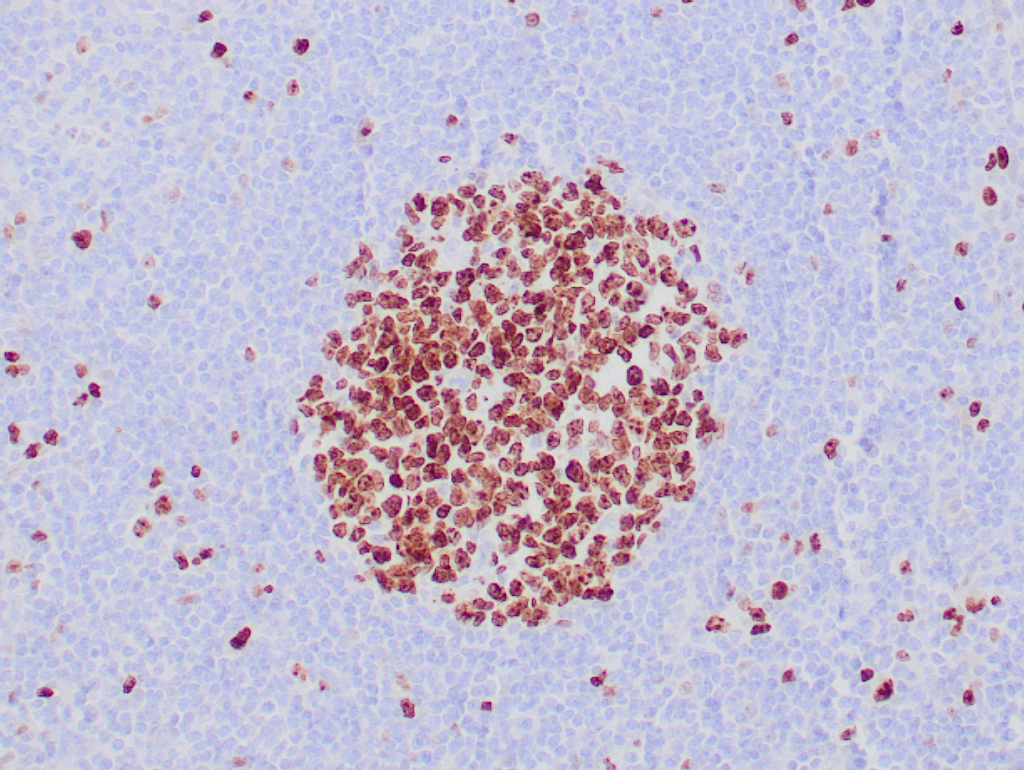 Ki-67 Antibody - Recombinant IVD Antibody for IHC - Zeta Corporation