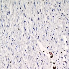 H3K27me3 antibody