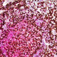 T-Cell Cocktail Dual Stain
