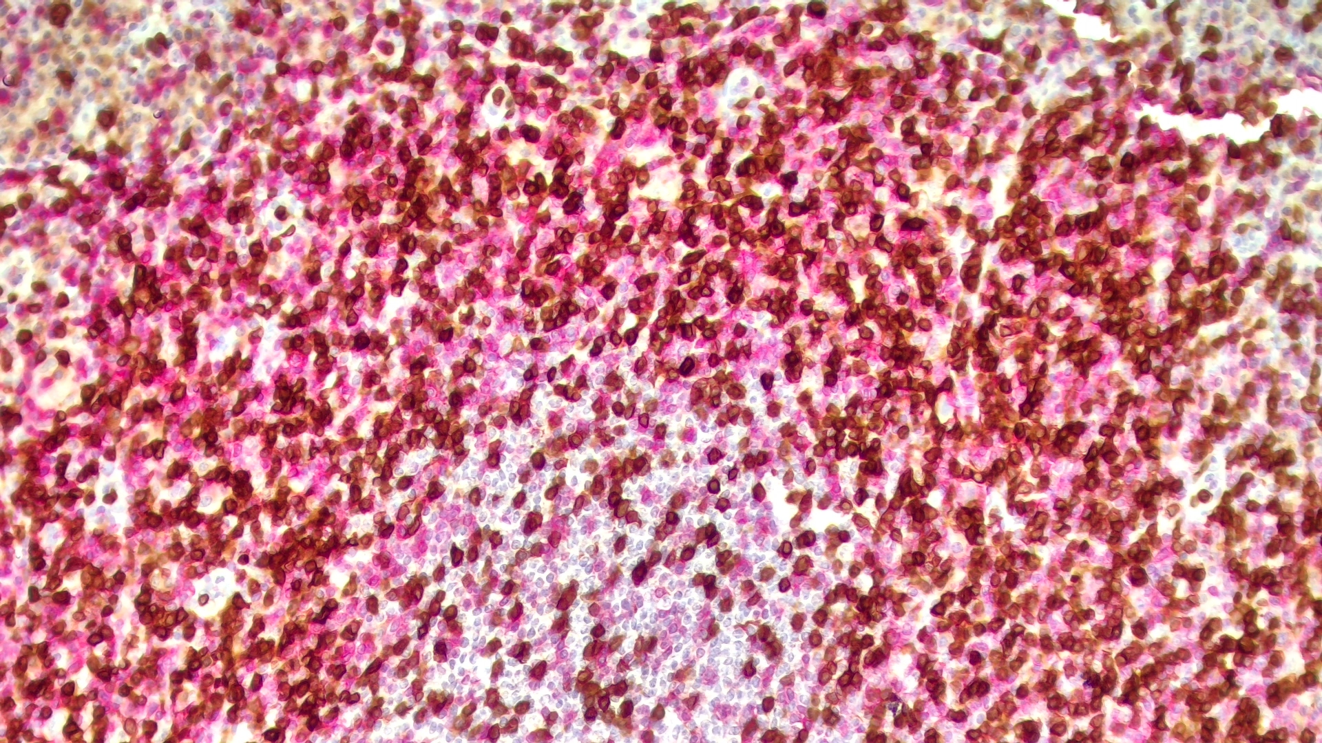 T CELL CLONALITY COCKTAIL