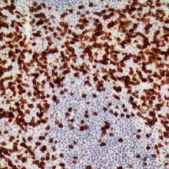 TRBC1 antibody