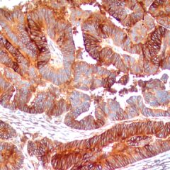 FOLR1 antibody