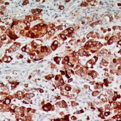 Uroplakin II Antibody