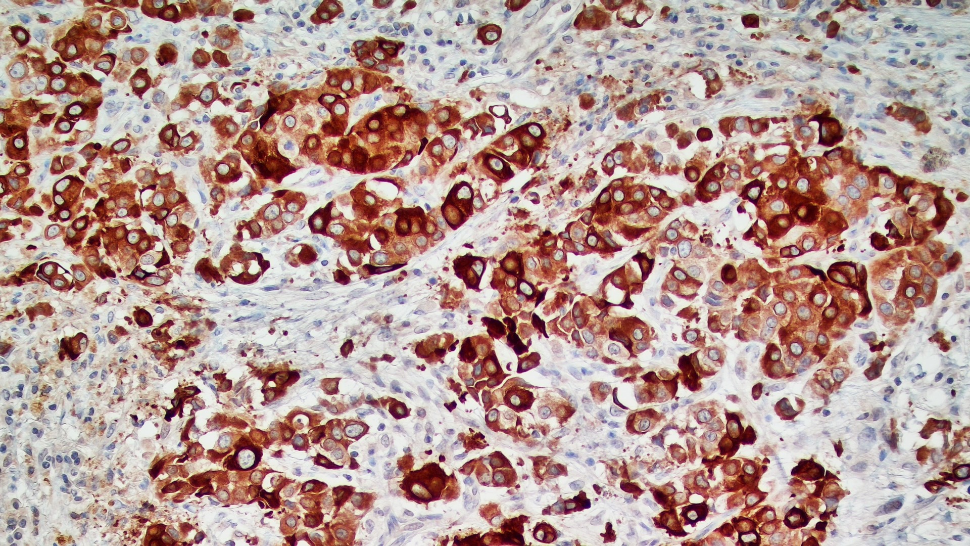 Uroplakin II