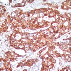 c-myc recombinant antibody